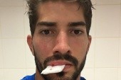 Lucas Silva uderzony telefonem komórkowym podczas meczu ligowego